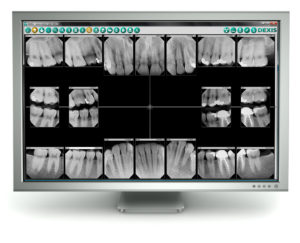 teeth_x-ray